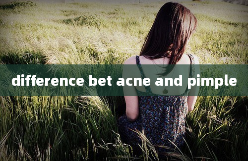 difference bet acne and pimple